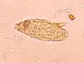 IPLab11Schistosomiasis2.jpg