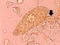 IPLab11Schistosomiasis1.jpg