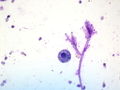 CytologicallyYoursUnknowns201310-6-05.jpg
