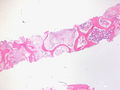 CytologicallyYoursCoW20131111Biopsy1.jpg