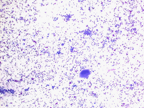 Cytologically Yours: CoW: 20131125 - Pathology Education Instructional