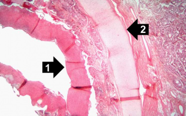 IPLab:Lab 9:Diphtheria - Pathology Education Instructional Resource