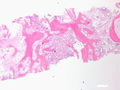 CytologicallyYoursCoW20131111Biopsy2.jpg