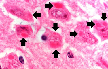 IPLab:Lab 8:Rabies - Pathology Education Instructional Resource