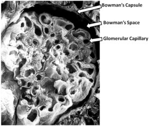 Histologic:Chapter 15 - Pathology Education Instructional Resource