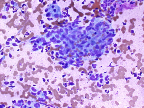 Cytologically Yours: CoW: 20131125 - Pathology Education Instructional ...