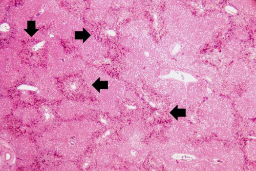 IPLab:Lab 4:Chronic Passive Congestion - Pathology Education ...
