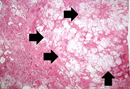 crypto pathology