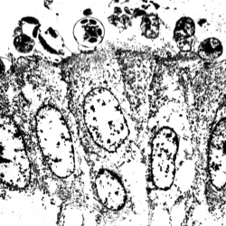 Electron Microscopy