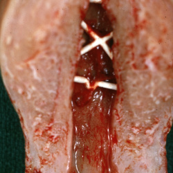 Female Reproductive