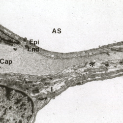 Electron Microscopy
