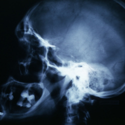 PEIR Pathology
