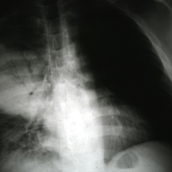 Radiology