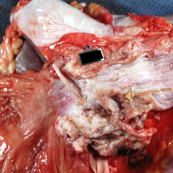 Gastrointestinal