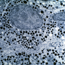 Endocrine