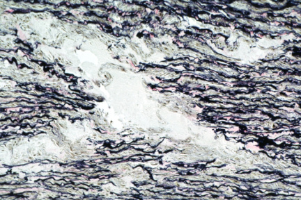 00003828