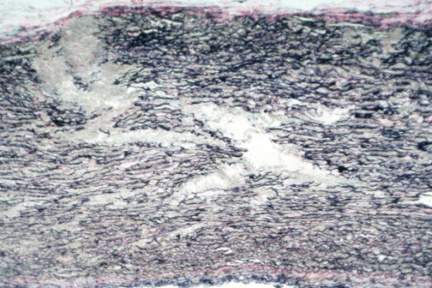 00003829