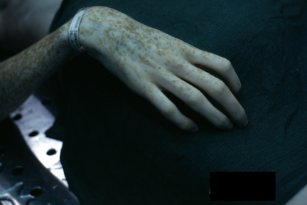 00004676
