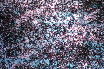 00006177