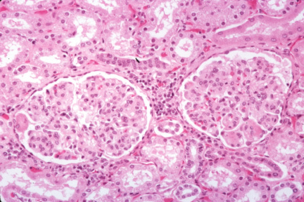 00006407