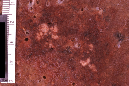 00006494