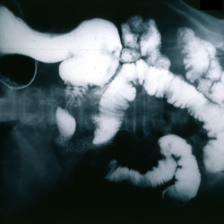 Radiology