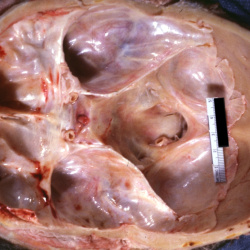 Head