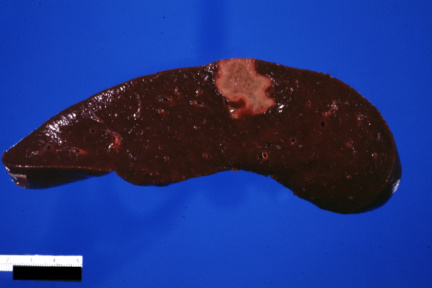 00009268