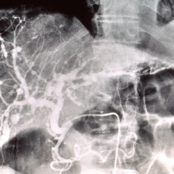 Radiology