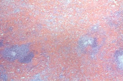 00016241