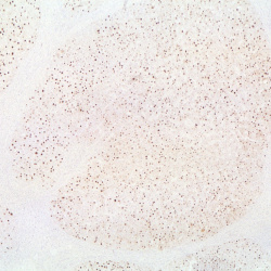 Immunohistochemistry