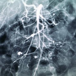 Radiology