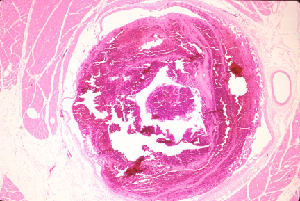 00016787
