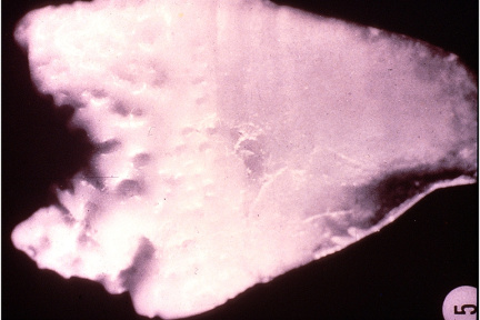 00095042