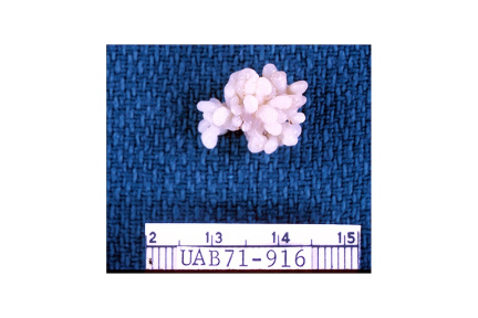 00095121