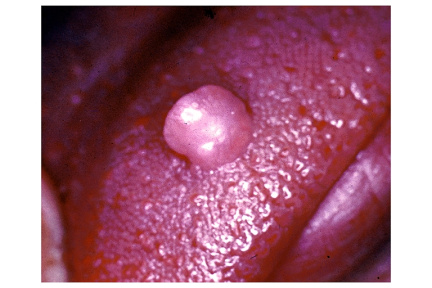 00095167