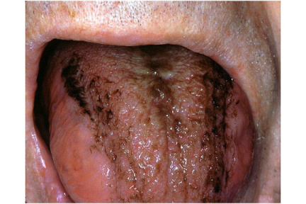 00095226