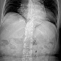 PEIR Radiology