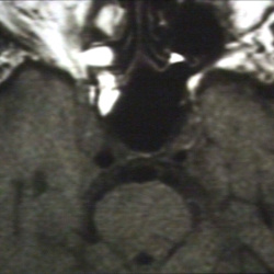 Radiology