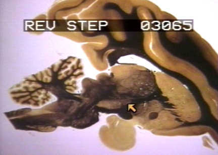 00203064
