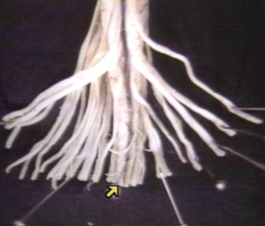 00203129