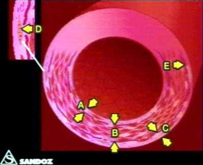 00203376