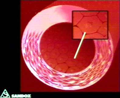00203378