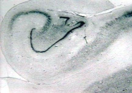 00204108