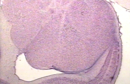 00204113