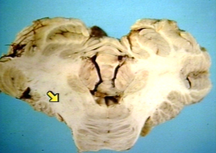 00204517