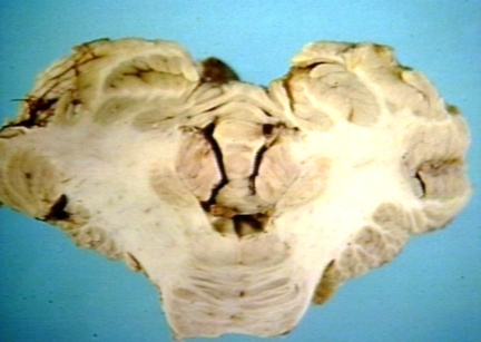 00204511