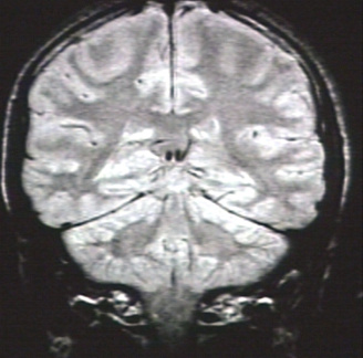 00204600