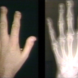 Radiology