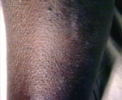 00205941